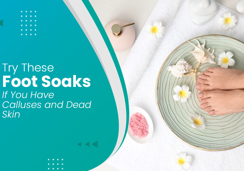 Try These Foot Soaks If You Have Calluses and Dead Skins