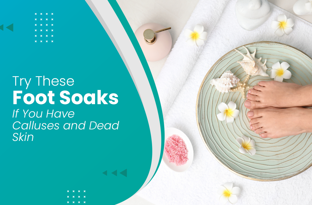 Try These Foot Soaks If You Have Calluses and Dead Skins